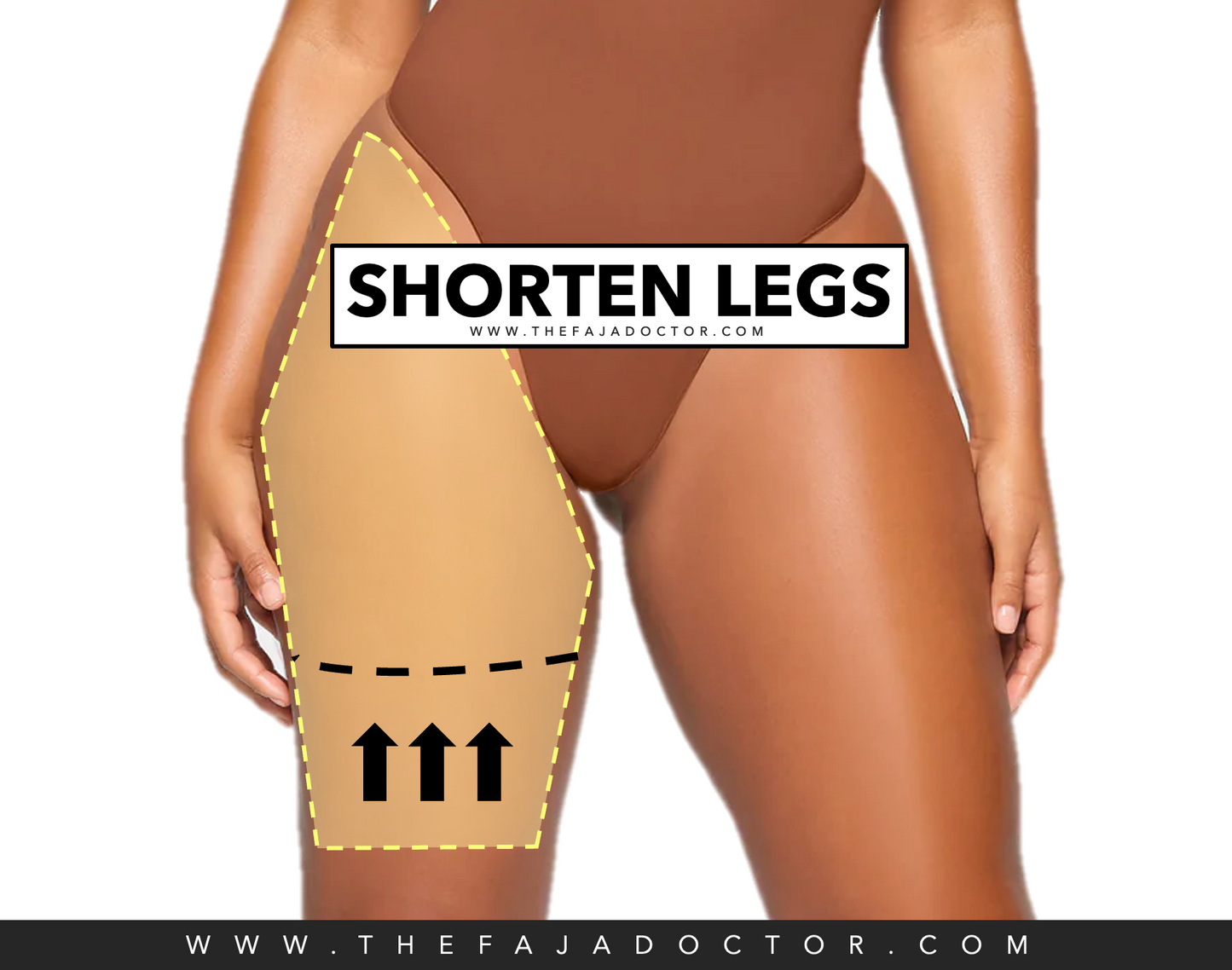 SHORTEN FAJA LEGS