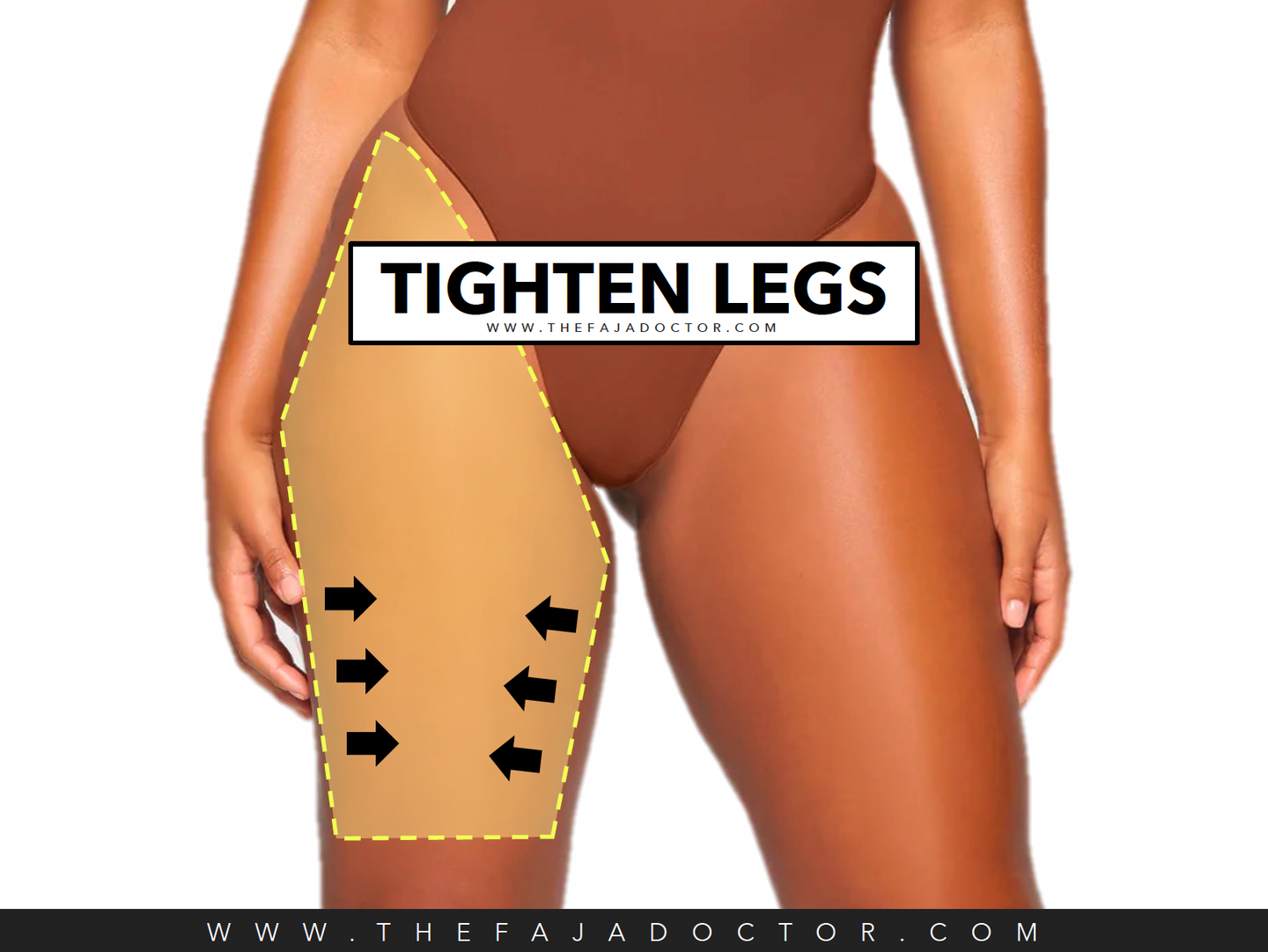 TIGHTEN FAJA LEGS