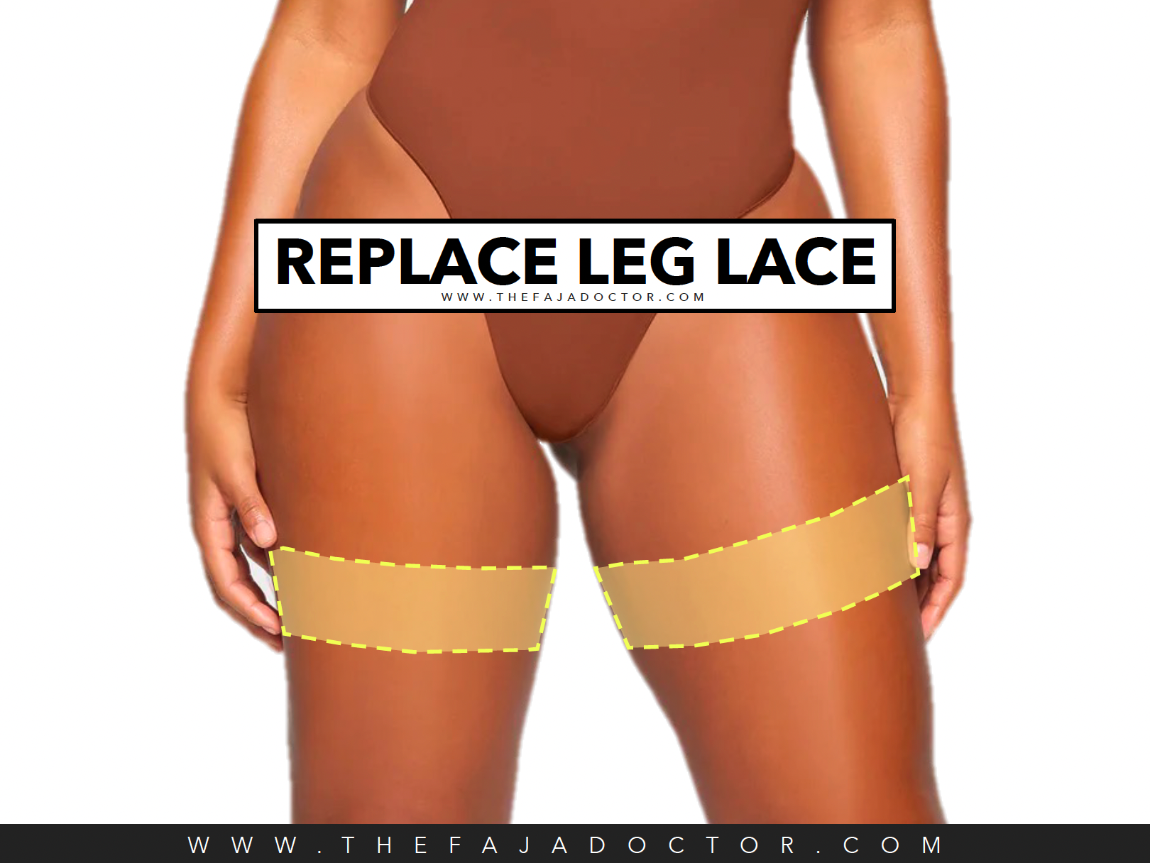 REPLACE LEG LACE